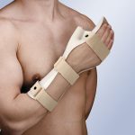 FÉRULA INMOVILIZADORA DE MANO EN POSICIÓN FUNCIONAL Y OPOSICIÓN DEL PULGAR